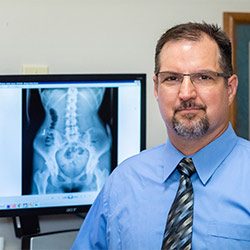 Chiropractor Marshalltown IA Dr Brian Fritz Gonstead X-Rays